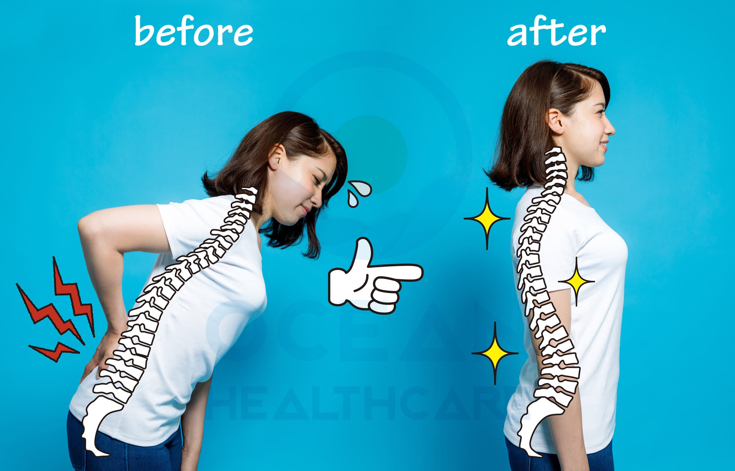 Điều trị đau lưng bằng nắn chỉnh cột sống chiropractic
